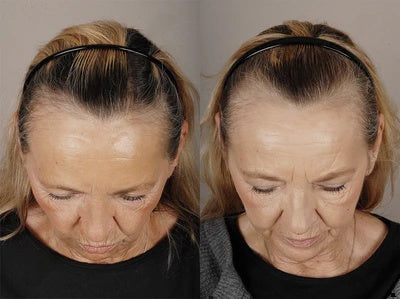 <p>Subjekt: Žena, 64 godine</p>